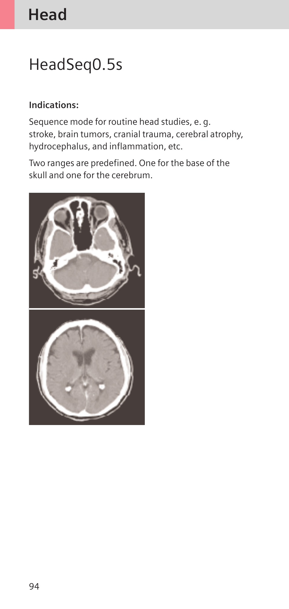 Head headseq0.5s | Siemens SOMATOM SENSATION CARDIAC A60 User Manual | Page 94 / 128