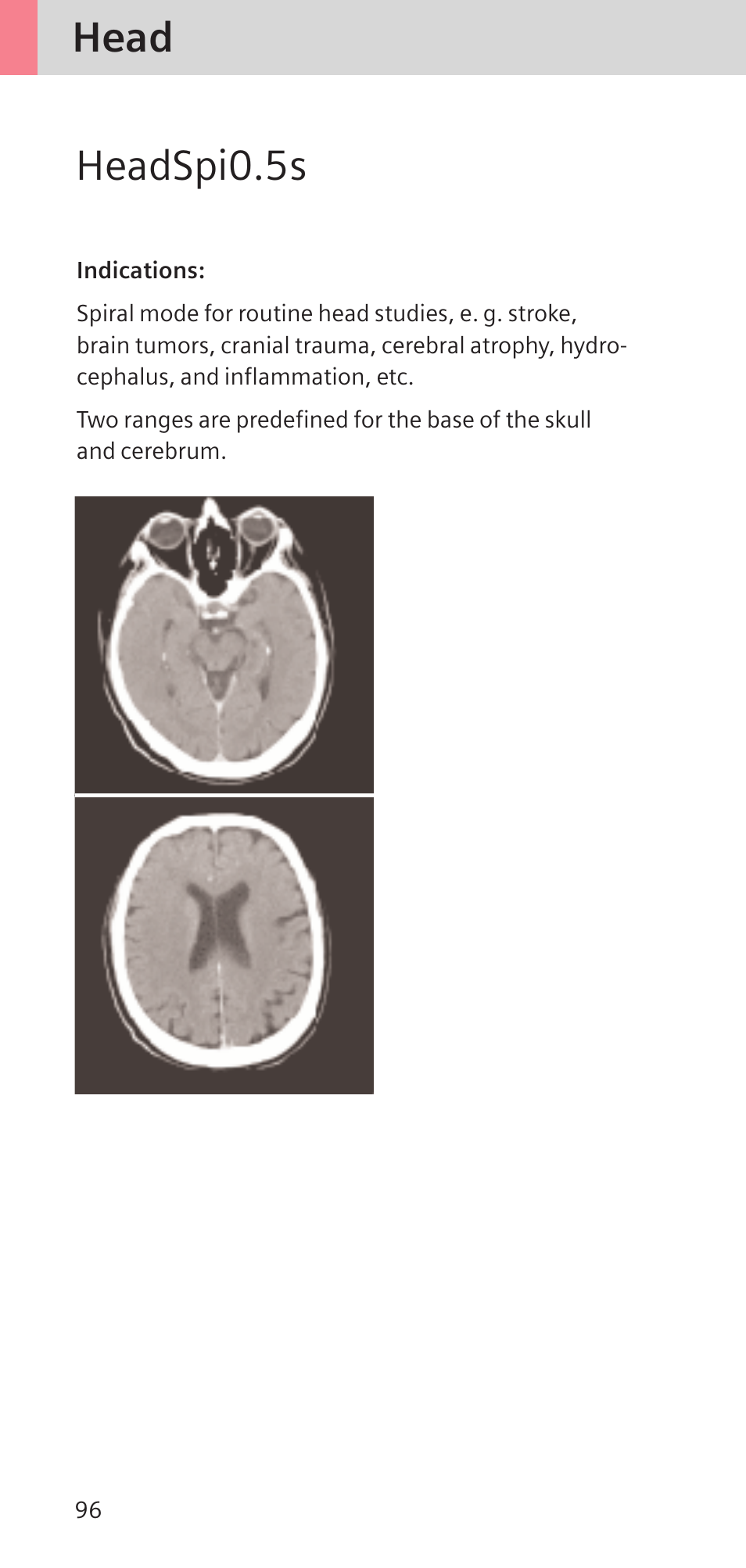 Head headspi0.5s | Siemens SOMATOM SENSATION CARDIAC A60 User Manual | Page 96 / 128