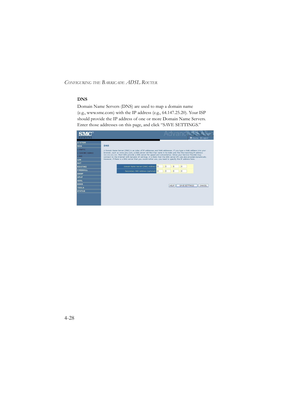 Adsl r | SMC Networks SMC7904BRA User Manual | Page 73 / 129