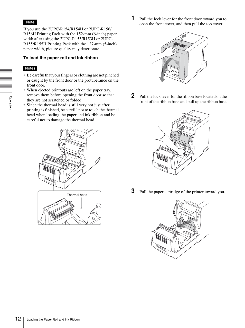 Sony UP-DR150 User Manual | Page 12 / 34
