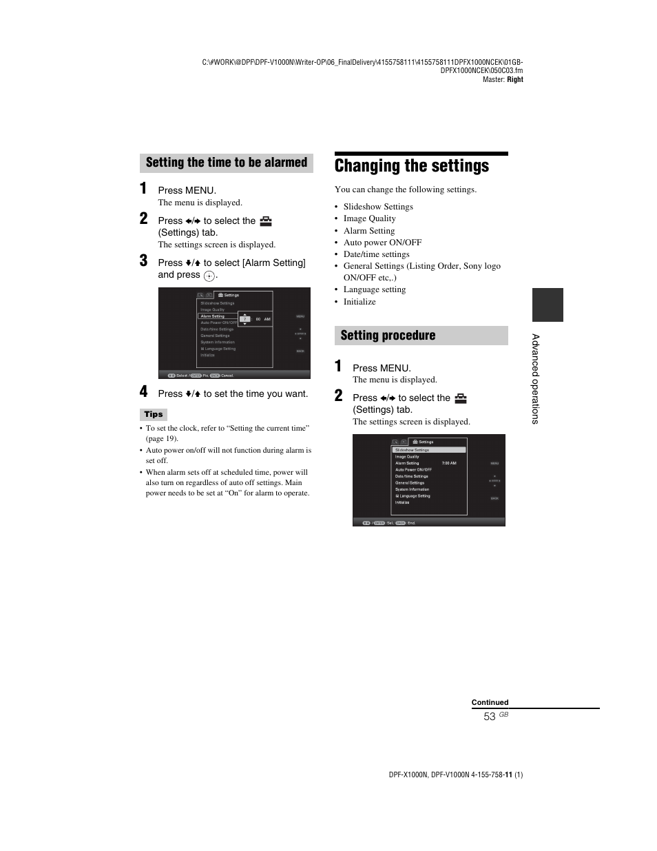 Setting the time to be alarmed, Changing the settings, Setting procedure | Setting the time to be alarmed setting procedure | Sony S-Frame DPF-V1000N User Manual | Page 53 / 80