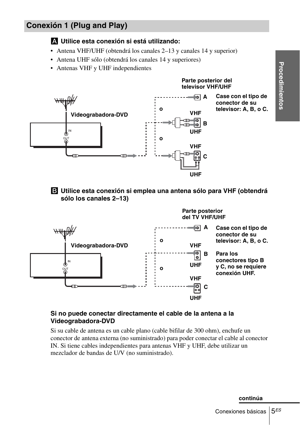 Conexión 1 (plug and play) | Sony SLV-D370P User Manual | Page 119 / 132