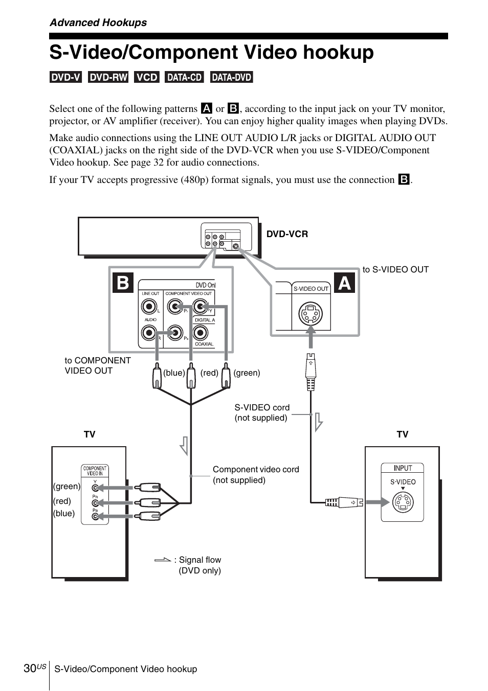 Advanced hookups, S-video/component video hookup | Sony SLV-D370P User Manual | Page 30 / 132