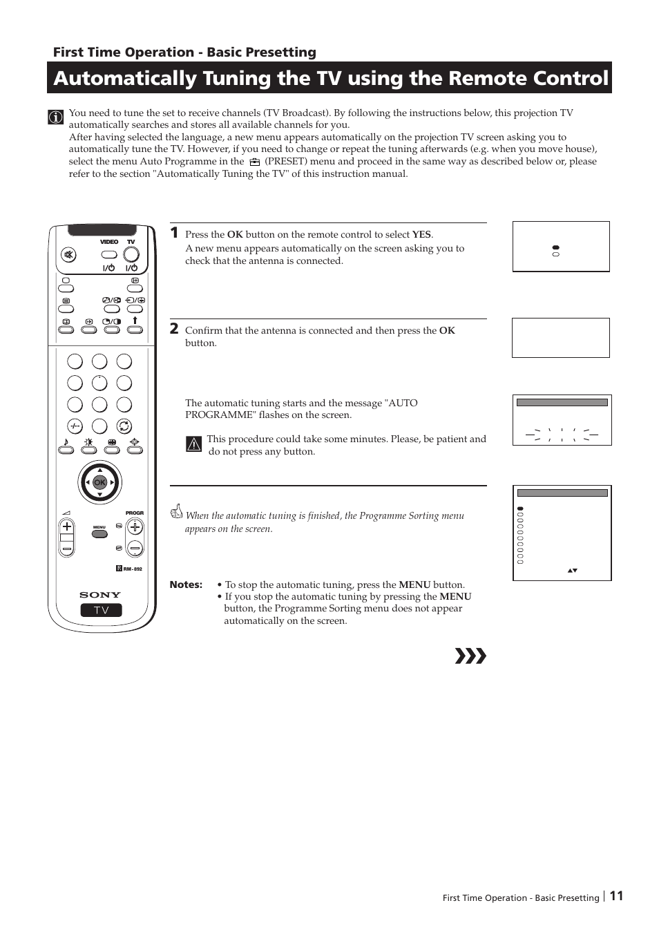 First time operation - basic presetting | Sony KP-41PZ1D User Manual | Page 11 / 135