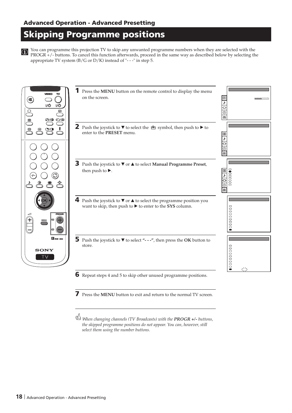 Skipping programme positions, Advanced operation - advanced presetting | Sony KP-41PZ1D User Manual | Page 18 / 135