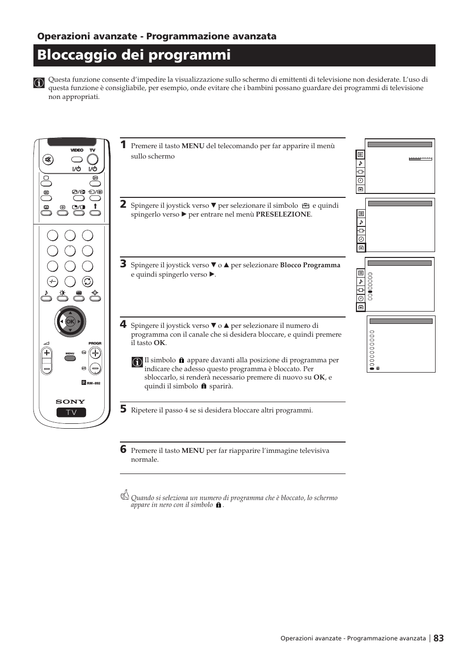 Bloccaggio dei programmi, Operazioni avanzate - programmazione avanzata | Sony KP-41PZ1D User Manual | Page 83 / 135