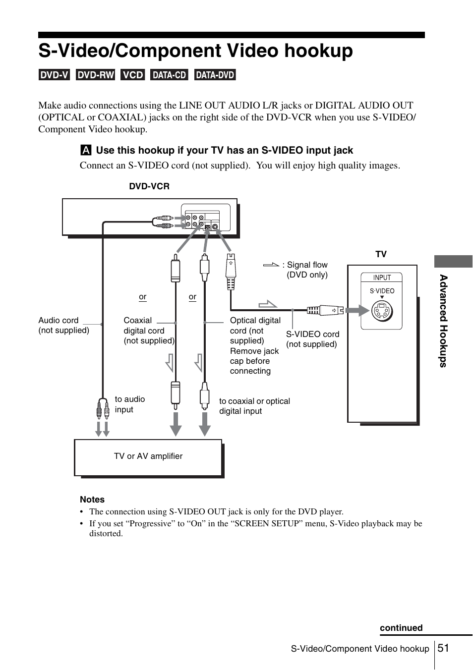 S-video/component video hookup | Sony SLV-D261P User Manual | Page 51 / 116