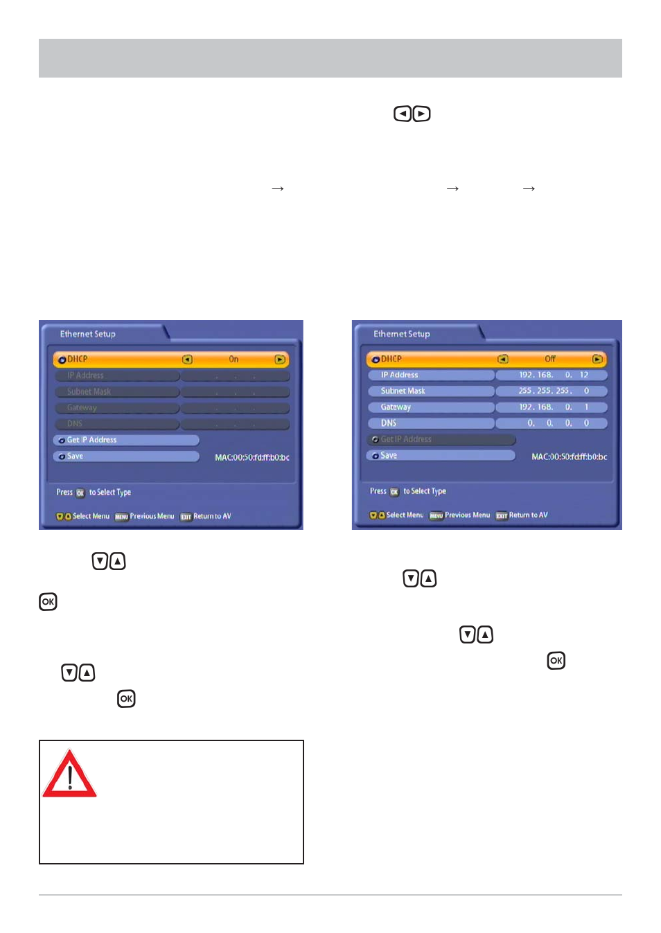 Dhcp “on, Dhcp “off, Setting system parameters | Dhcp server/router), Hub/switch/direct connection to pc or laptop) | Kathrein UFC 861si User Manual | Page 39 / 128