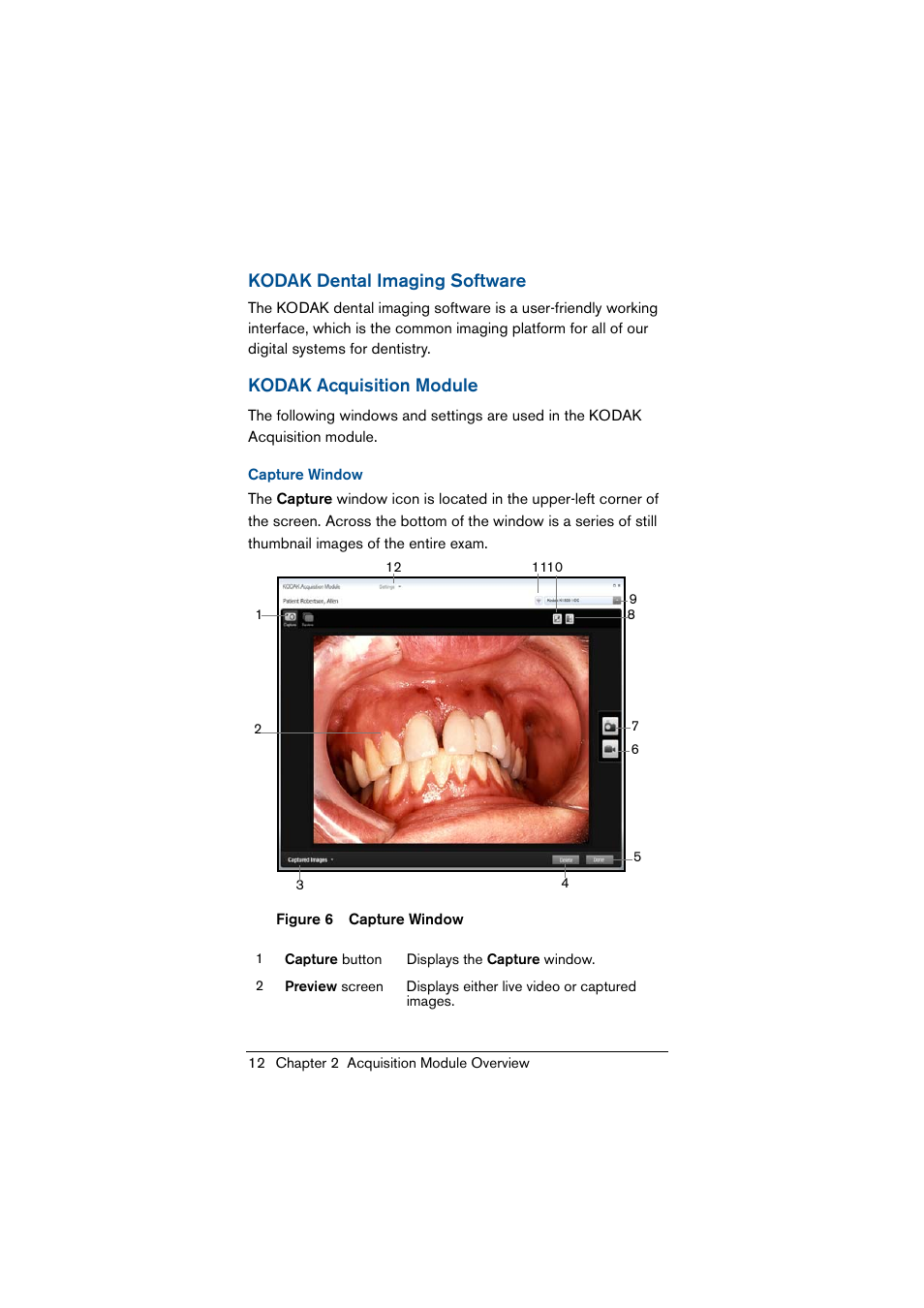 Kodak dental imaging software, Kodak acquisition module, Capture window | Kodak dental imaging | Kodak 1500 User Manual | Page 20 / 60