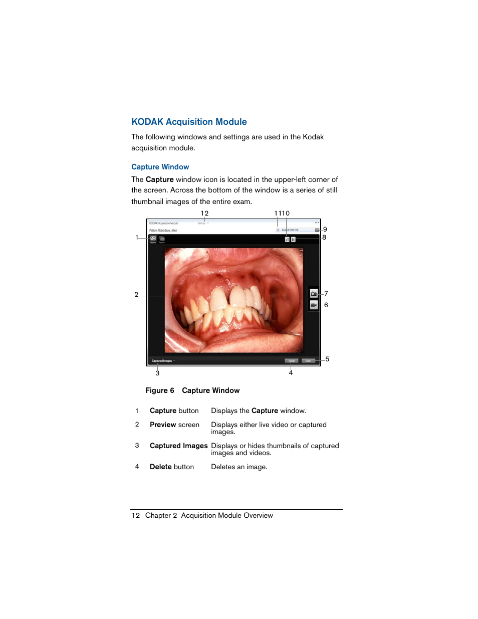 Kodak acquisition module, Capture window | Kodak INTRAORAL 1500 User Manual | Page 20 / 54