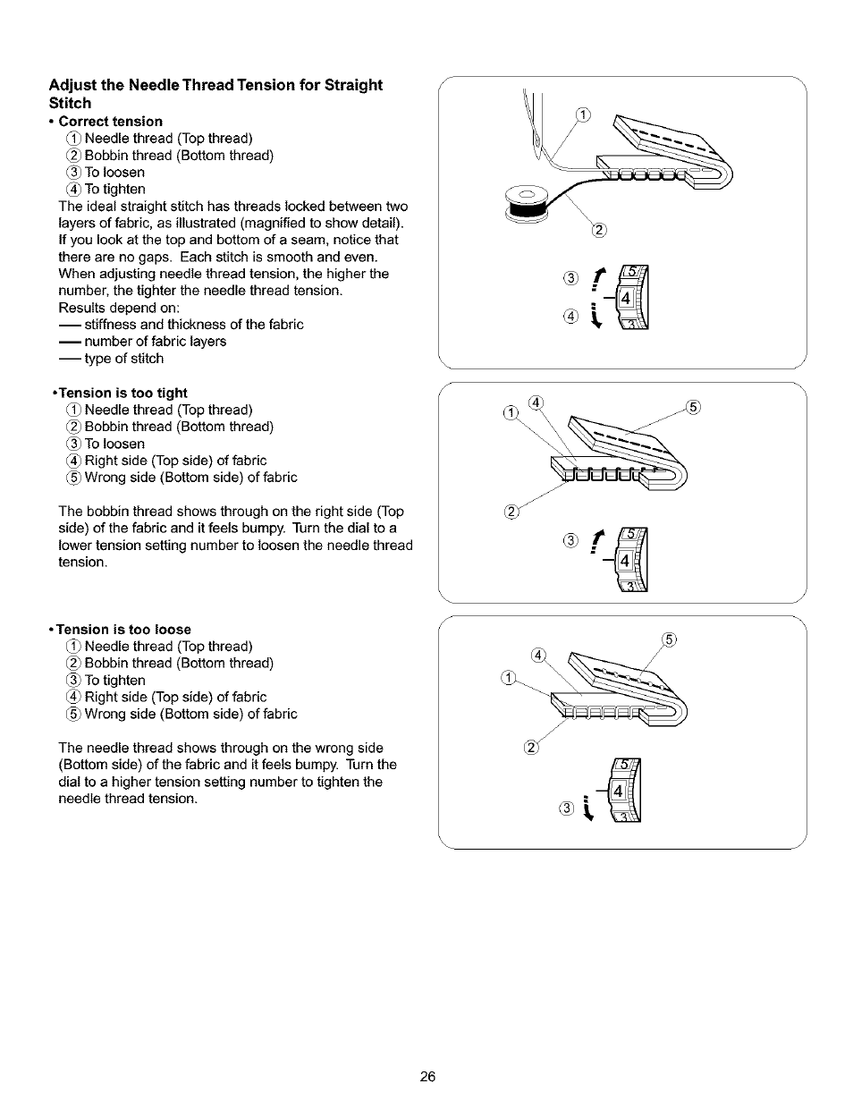 Tension is too tight, Tension is too ioose, Tension is too tight • tension is too loose | Kenmore 385.16120200 User Manual | Page 34 / 85