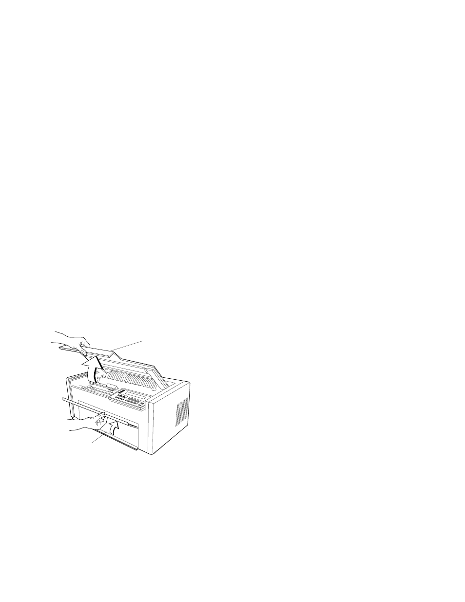 Removing the continuous forms device (f1) | Lexmark 302 User Manual | Page 73 / 274