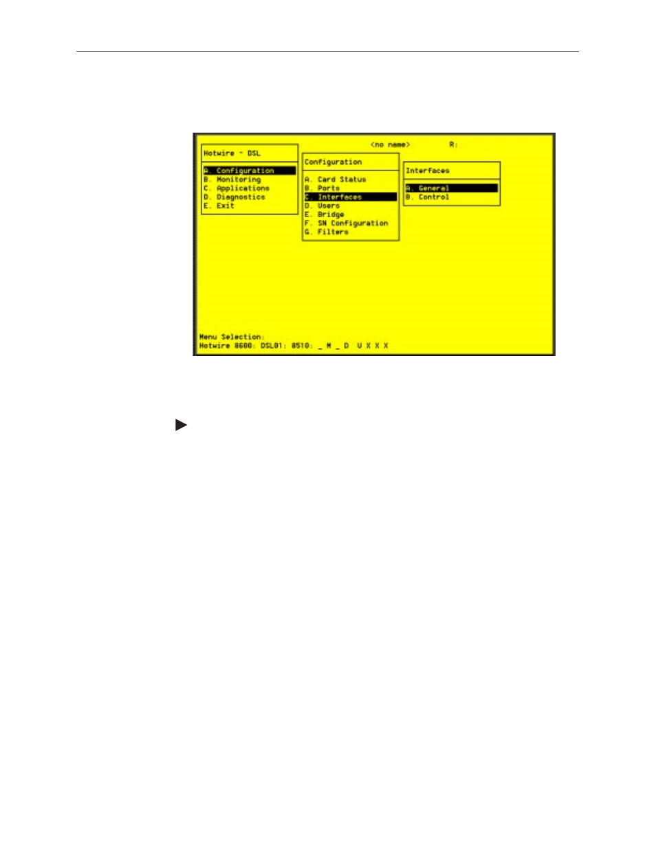 Dsl configuration interfaces screens | Paradyne 8310 MVLt User Manual | Page 46 / 108
