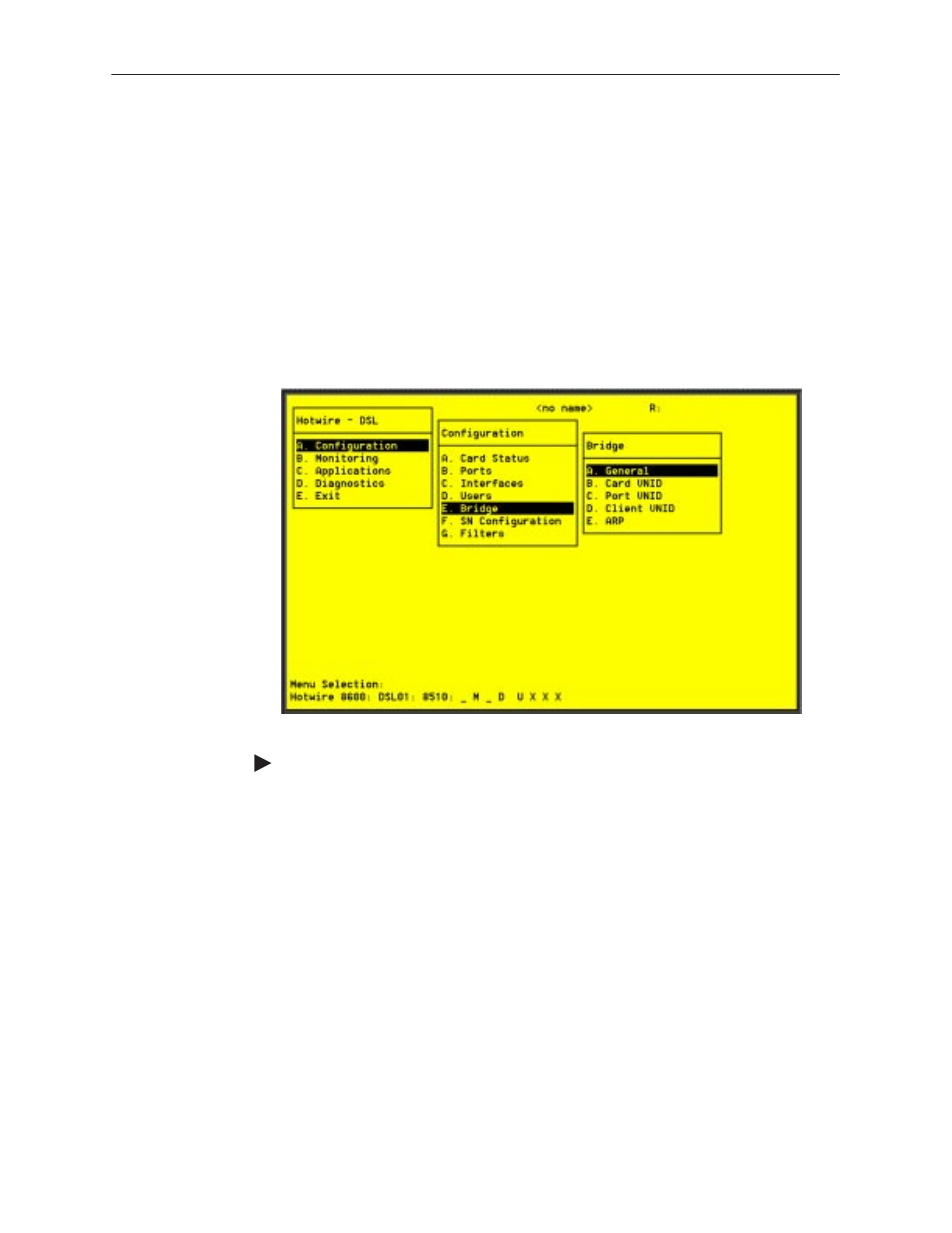 Dsl configuration users screens, Dsl configuration bridge screens | Paradyne 8310 MVLt User Manual | Page 48 / 108