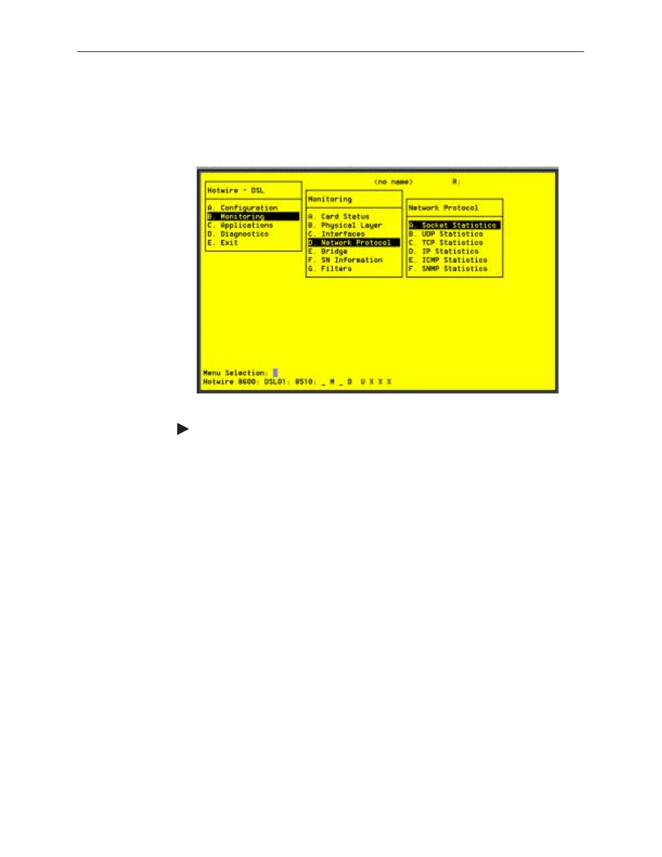 Dsl network protocol screens | Paradyne 8310 MVLt User Manual | Page 68 / 108