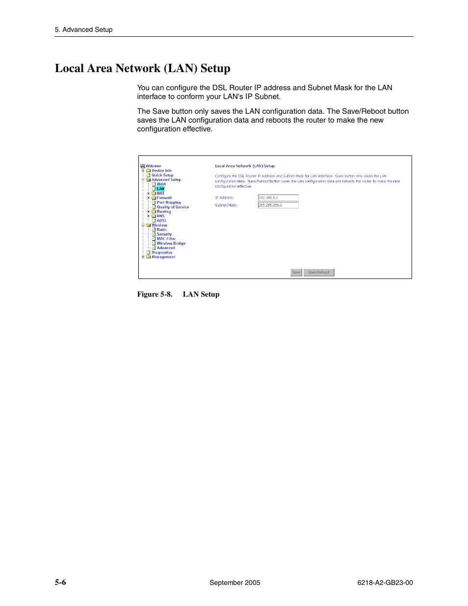 Local area network (lan) setup | Paradyne 6218-I1 User Manual | Page 46 / 92