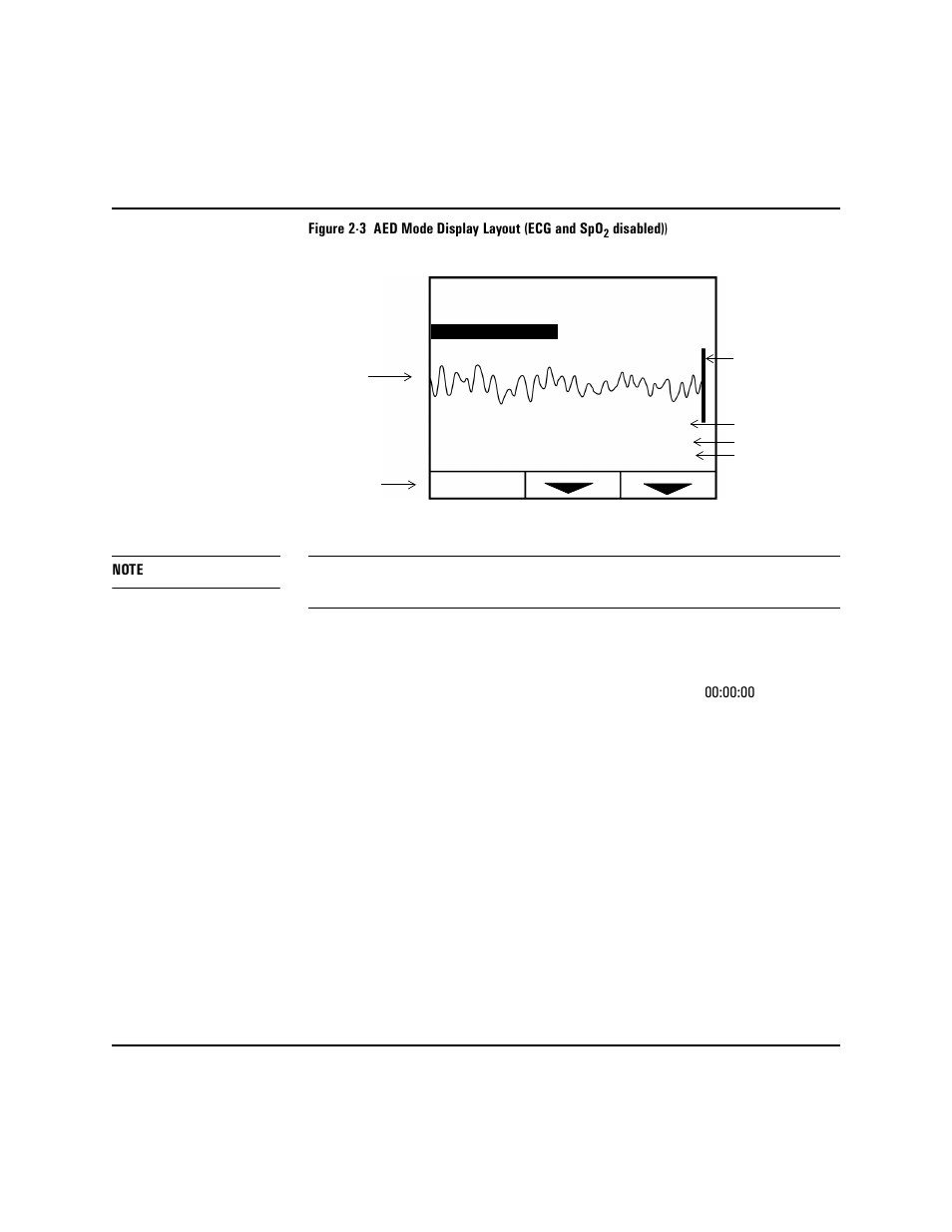 Philips HEARTSTART XLT M3500B User Manual | Page 26 / 180