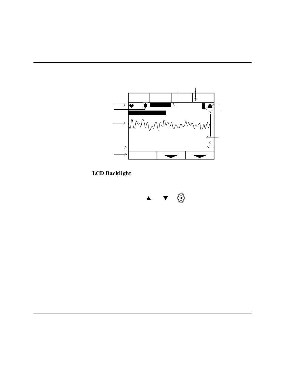 Lcd backlight, Lcd backlight -8 | Philips HEARTSTART XLT M3500B User Manual | Page 28 / 180