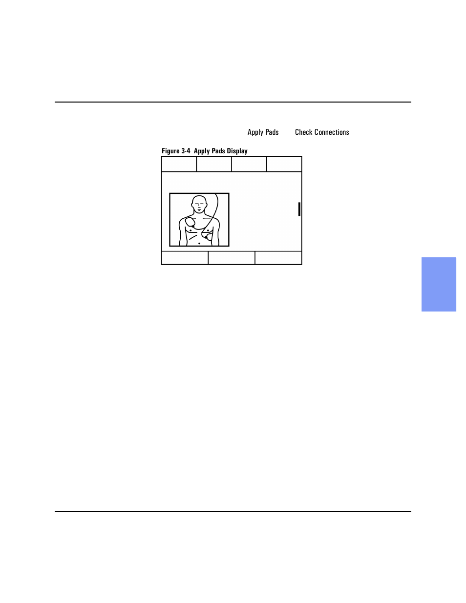 Philips HEARTSTART XLT M3500B User Manual | Page 41 / 180
