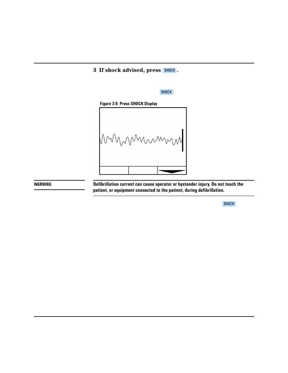Philips HEARTSTART XLT M3500B User Manual | Page 44 / 180