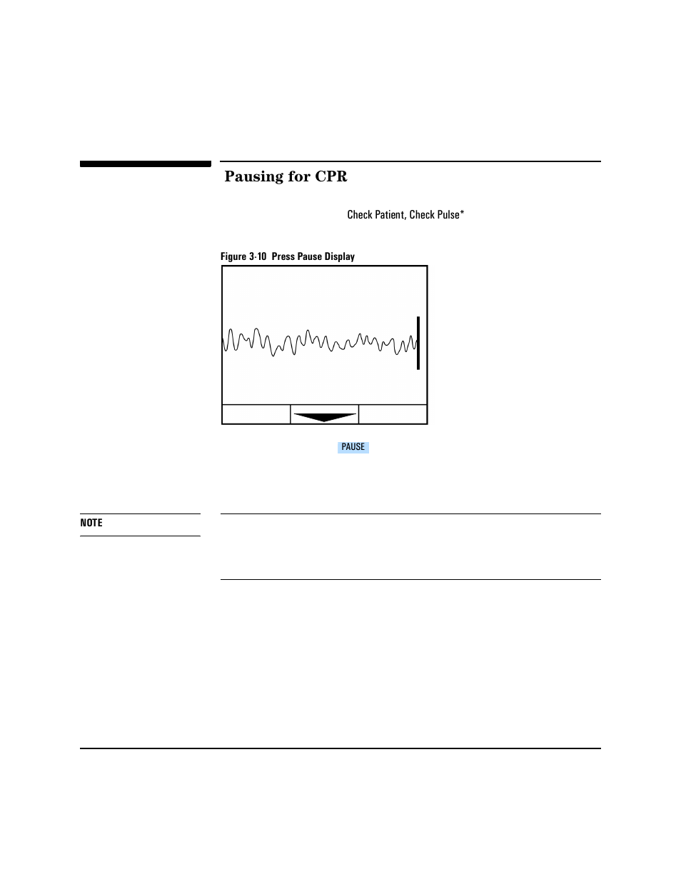 Pausing for cpr, Pausing for cpr -12 | Philips HEARTSTART XLT M3500B User Manual | Page 46 / 180