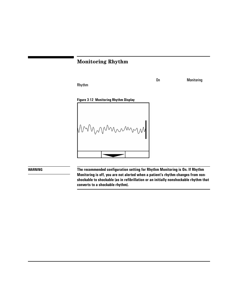 Monitoring rhythm, Monitoring rhythm -14 | Philips HEARTSTART XLT M3500B User Manual | Page 48 / 180