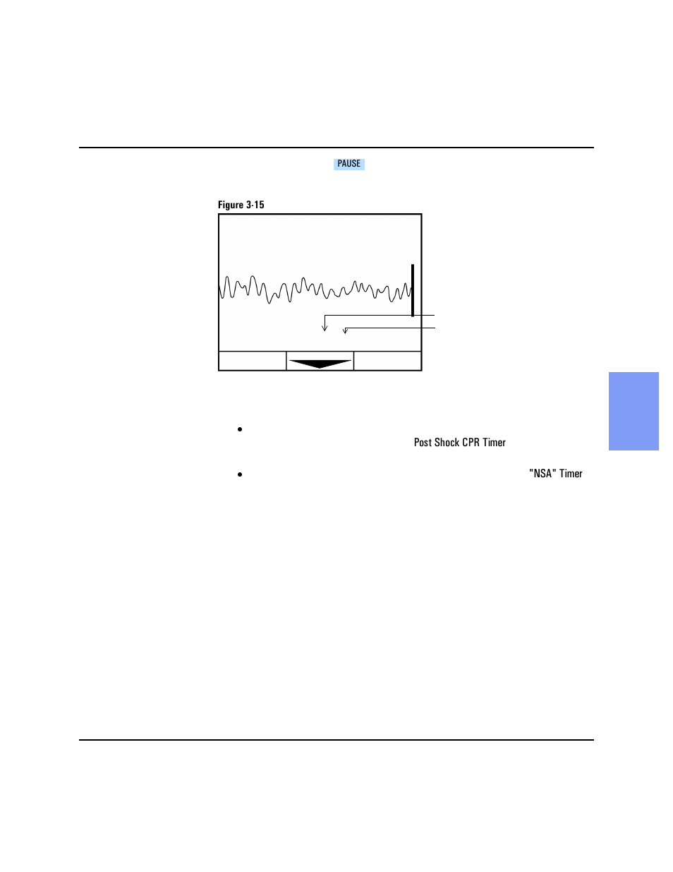 Philips HEARTSTART XLT M3500B User Manual | Page 51 / 180