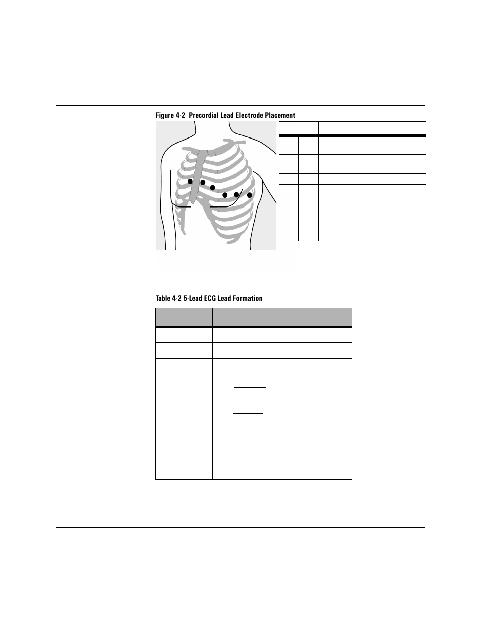 Philips HEARTSTART XLT M3500B User Manual | Page 56 / 180