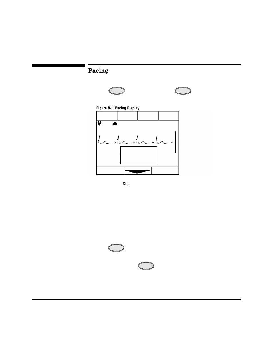 Pacing, Pacing -4, Nd “pacing” ch | Philips HEARTSTART XLT M3500B User Manual | Page 86 / 180