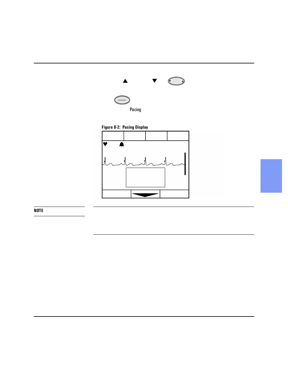 Philips HEARTSTART XLT M3500B User Manual | Page 87 / 180