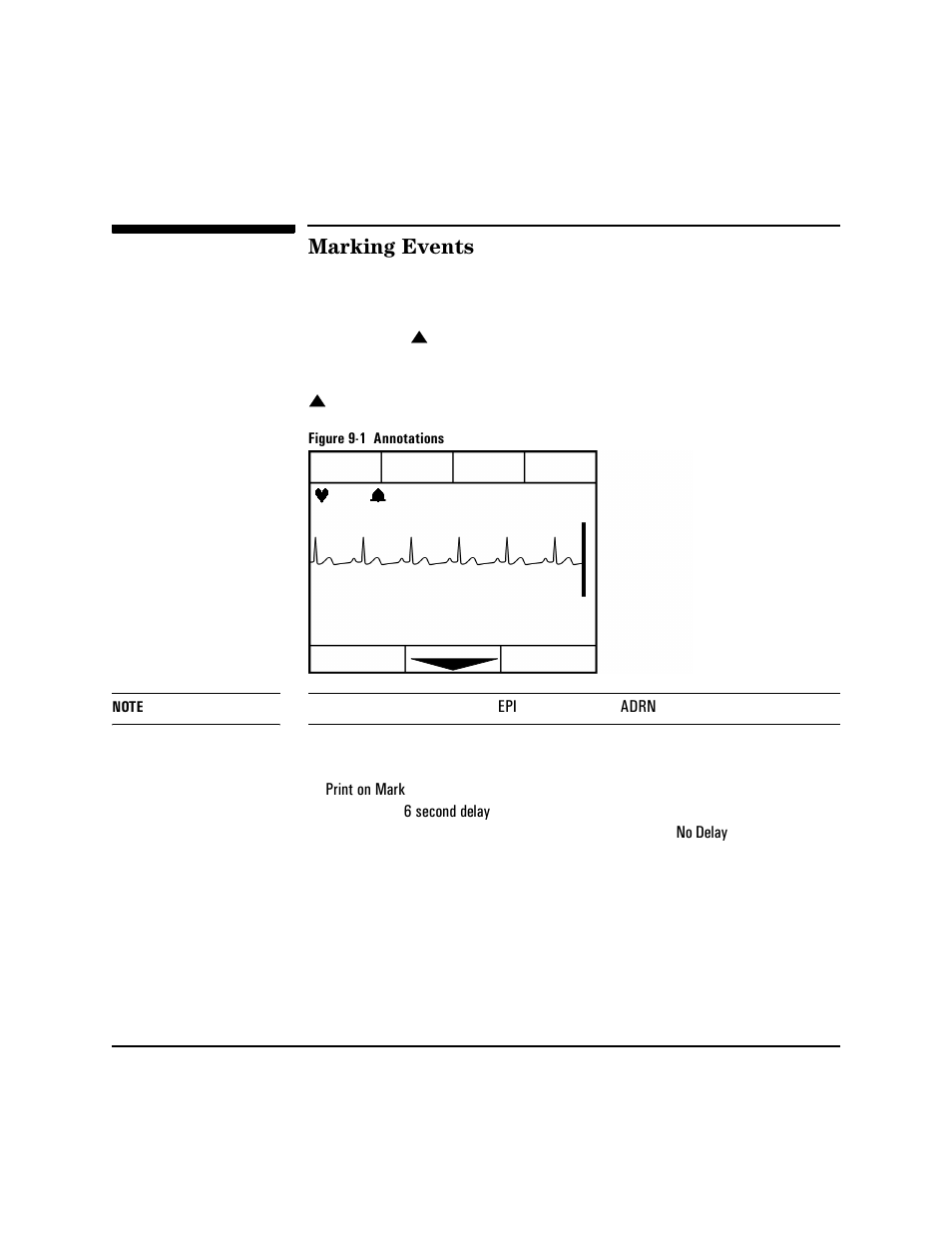 Marking events, Marking events -2 | Philips HEARTSTART XLT M3500B User Manual | Page 92 / 180