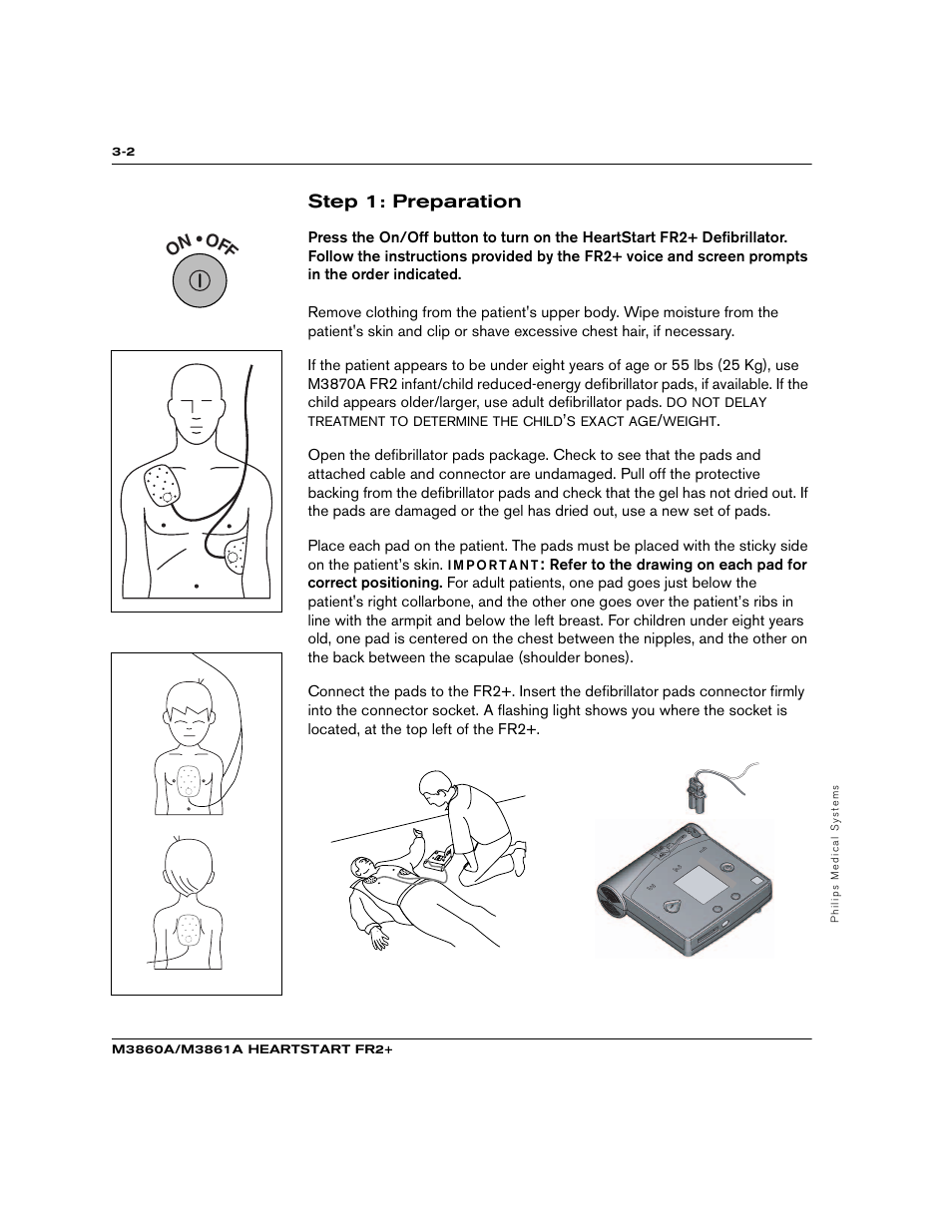 Step 1: preparation | Philips M3860A User Manual | Page 22 / 102