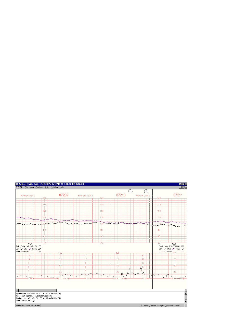 Alerting, Transducers, Chart-ready documentation using a printer | Traditional documentation using the recorder, Monitor connectors and interfaces, Self test, Mounting, Interface to pc | Philips M2925A User Manual | Page 2 / 8