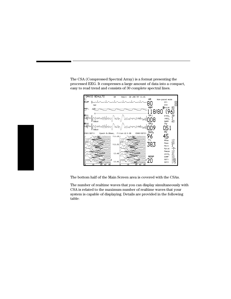 Csa display (cms only), Csa display (cms only) -28 | Philips V24CT User Manual | Page 102 / 392