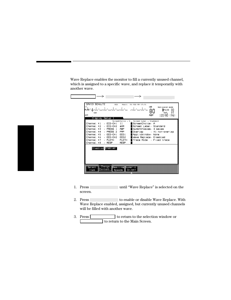 Wave replace, Procedure, Wave replace -30 | Procedure -30 | Philips V24CT User Manual | Page 104 / 392