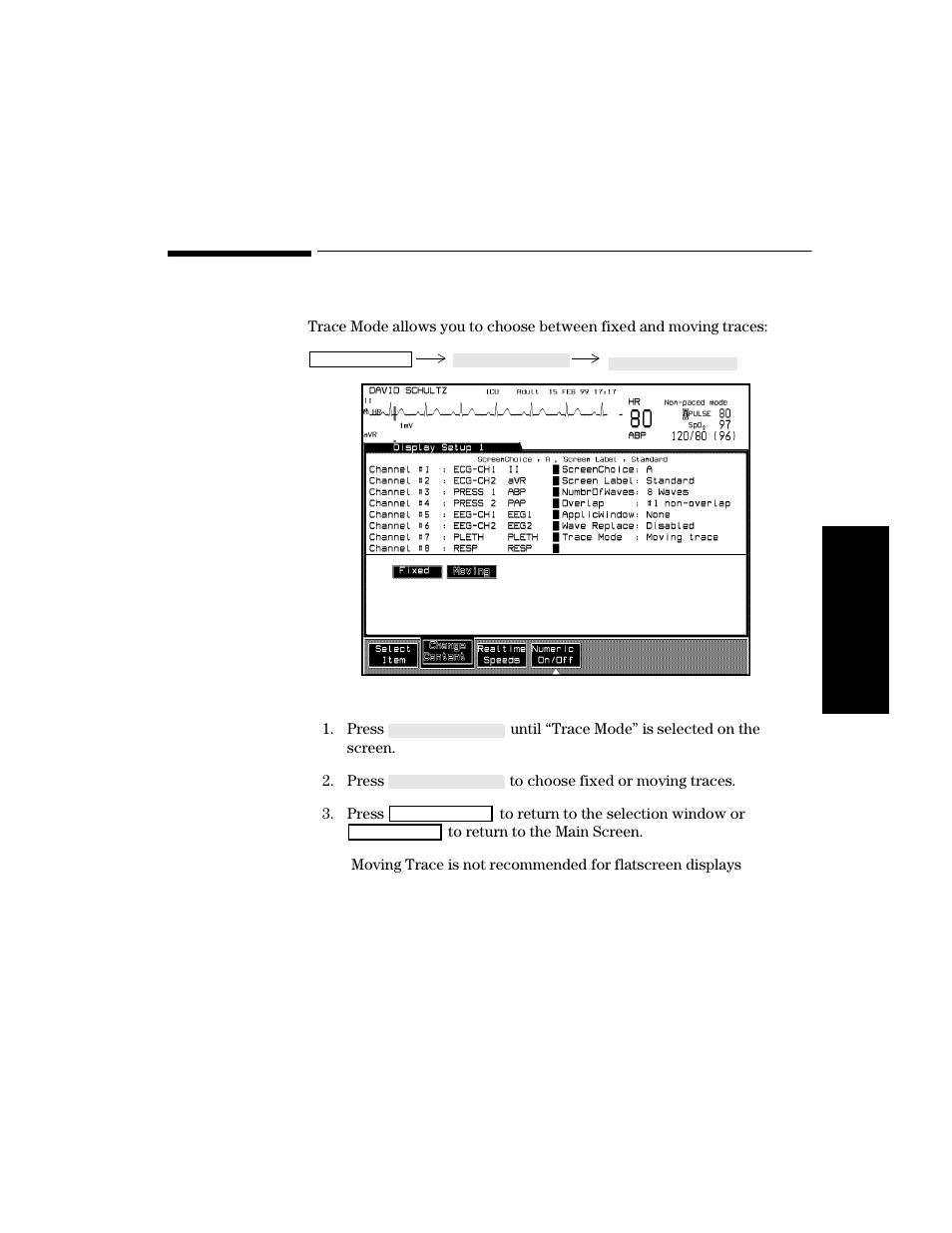 Trace mode, Procedure, Trace mode -31 | Procedure -31 | Philips V24CT User Manual | Page 105 / 392