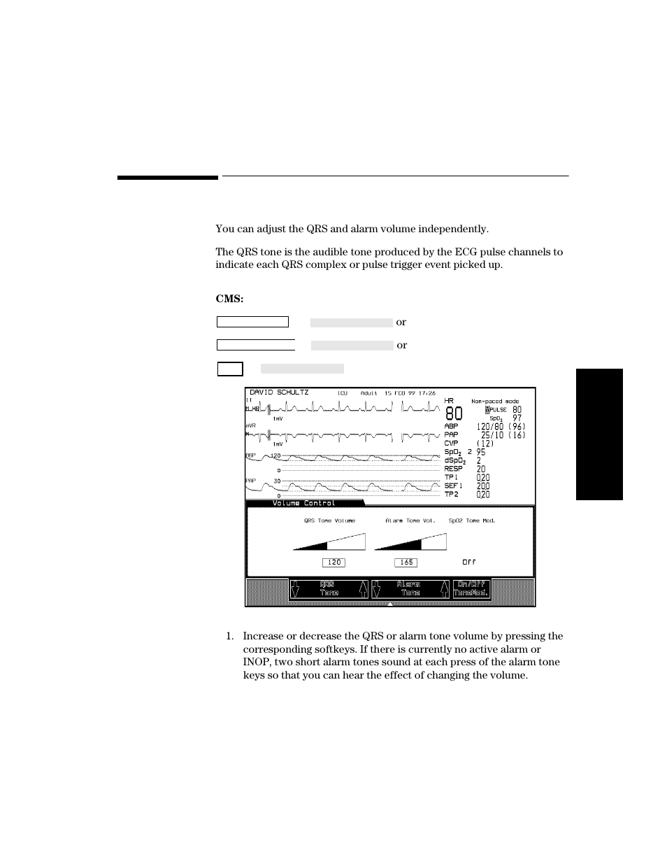 Adjusting the volume control, Procedure, Adjusting the volume control -35 | Procedure -35 | Philips V24CT User Manual | Page 109 / 392