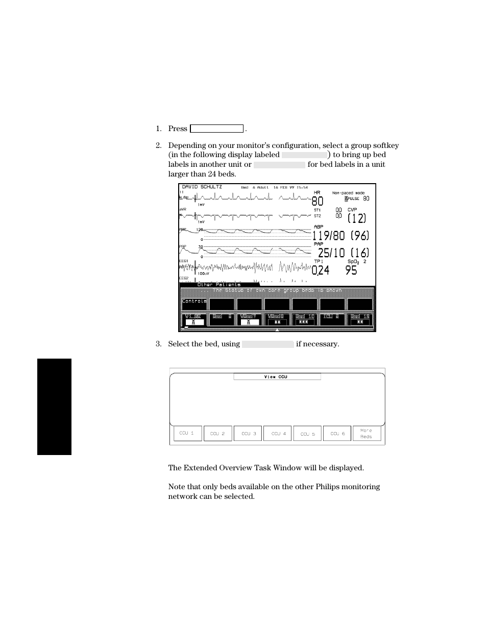 To view an extended other patients bed, To view an extended other patients bed -16 | Philips V24CT User Manual | Page 154 / 392