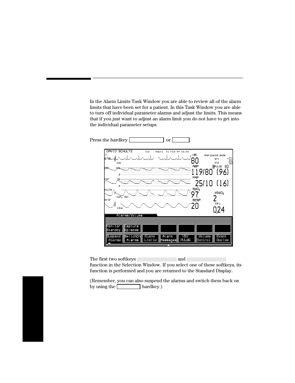Alarm setup, Getting into the alarms selection window, Alarm setup -12 | Getting into the alarms selection window -12 | Philips V24CT User Manual | Page 168 / 392