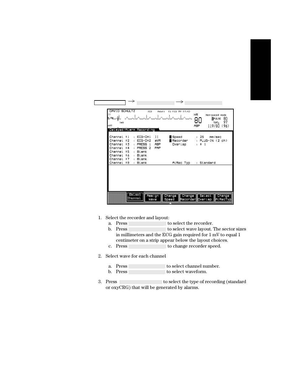 Configuring delayed recordings, Configuring delayed recordings -9 | Philips V24CT User Manual | Page 181 / 392