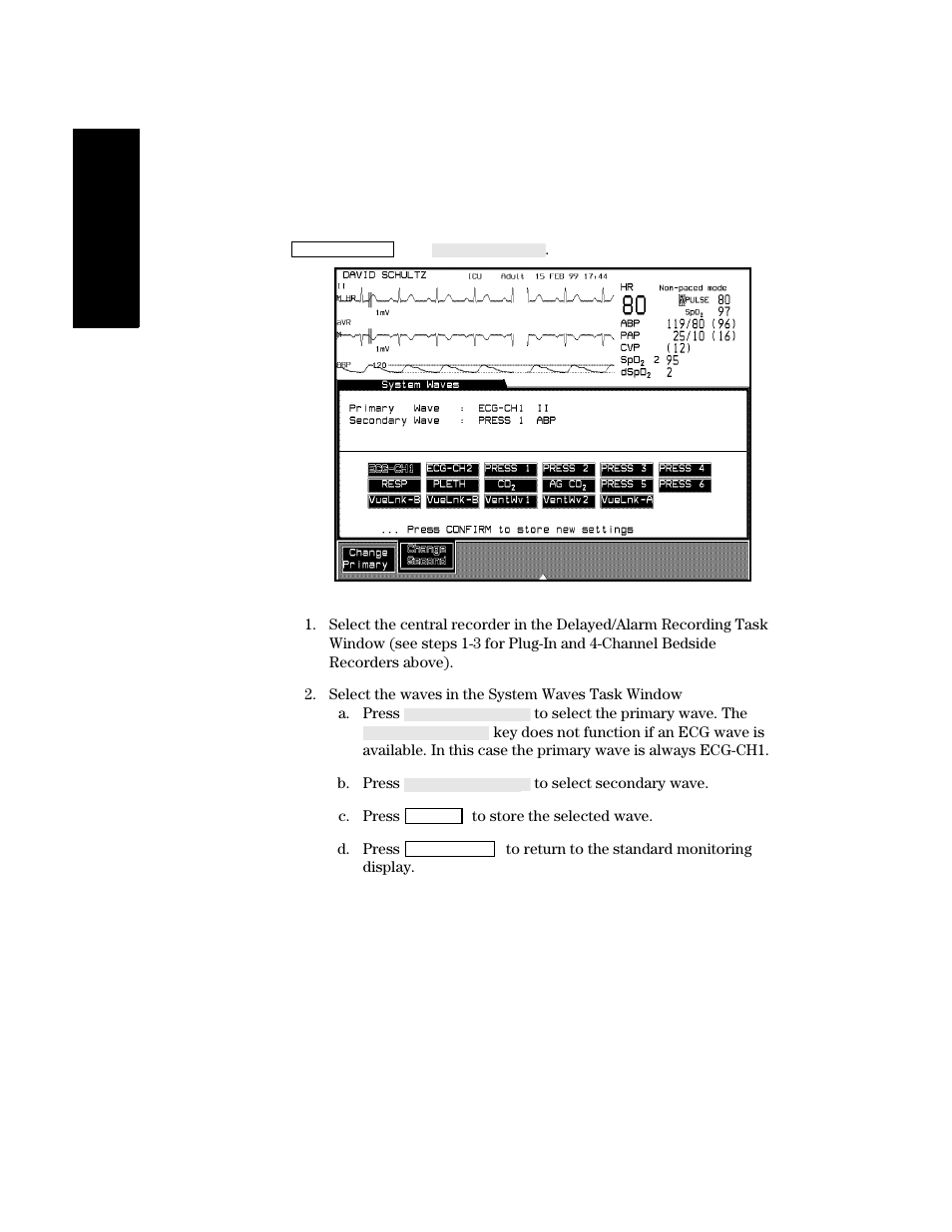 Philips V24CT User Manual | Page 182 / 392