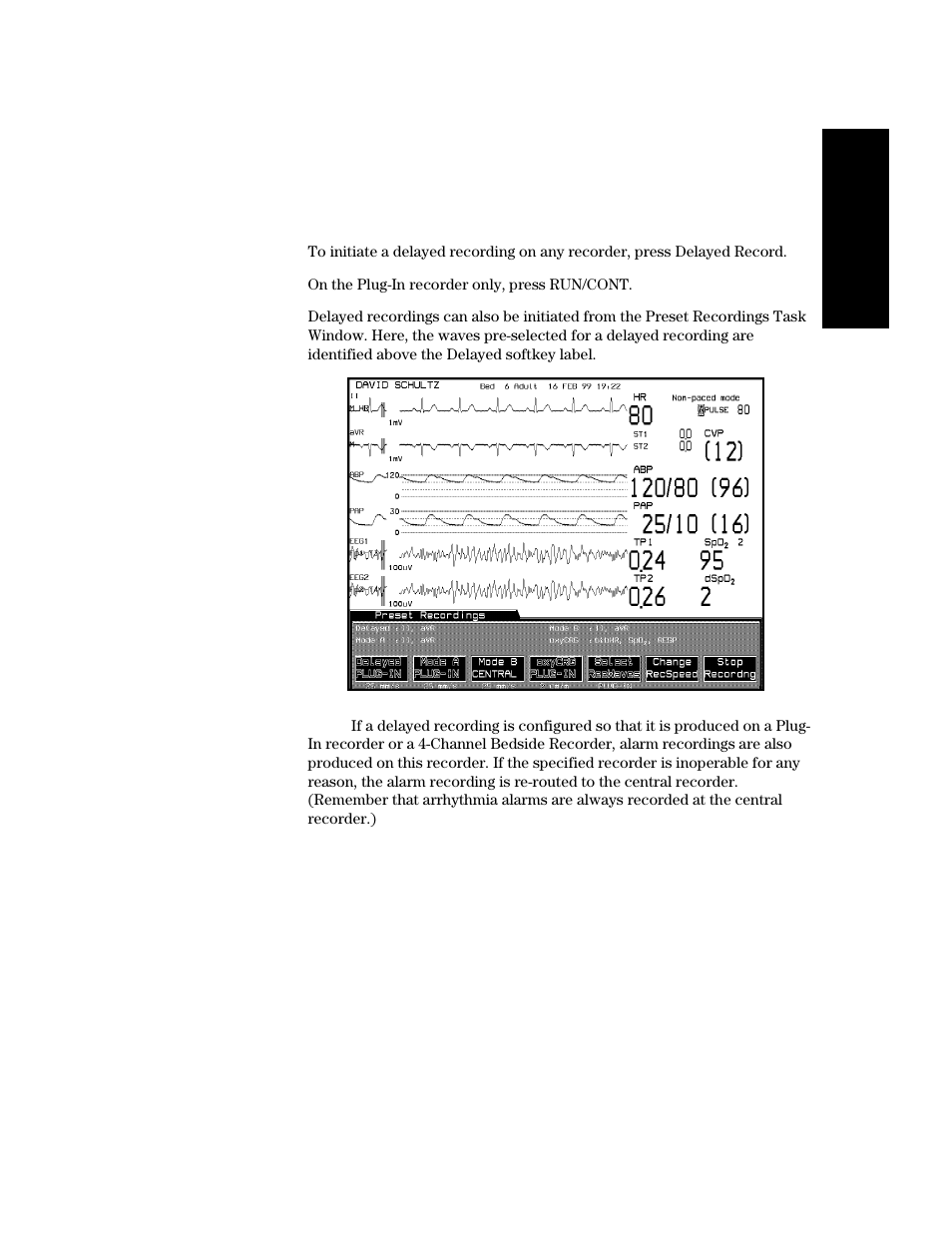 Making delayed recordings, Making delayed recordings -11 | Philips V24CT User Manual | Page 183 / 392
