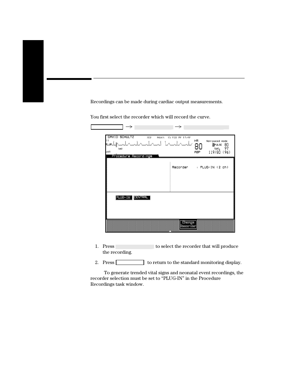Procedure recordings, Configuring procedure recordings, Procedure recordings -16 | Configuring procedure recordings -16 | Philips V24CT User Manual | Page 188 / 392