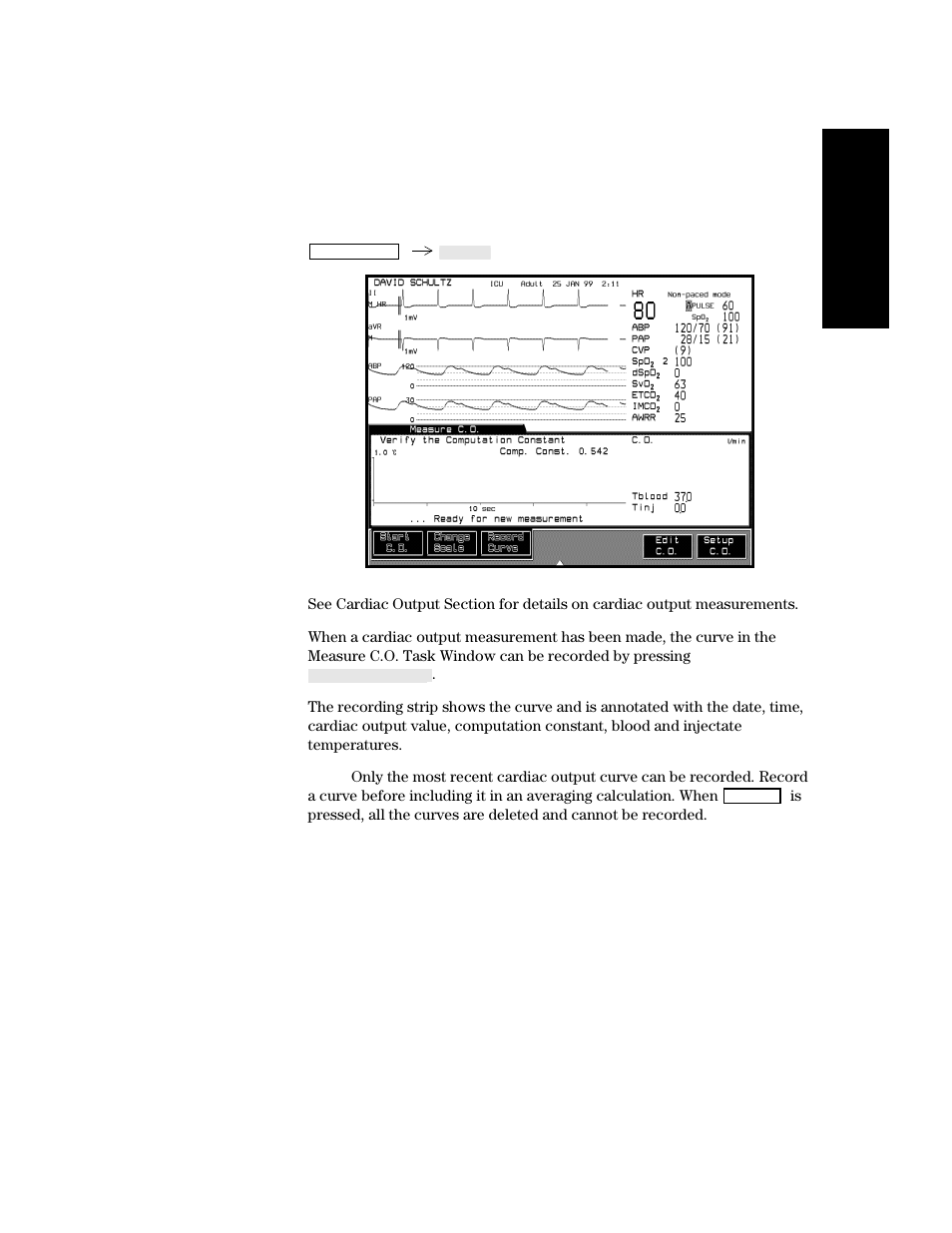 Making procedure recordings, Making procedure recordings -17 | Philips V24CT User Manual | Page 189 / 392