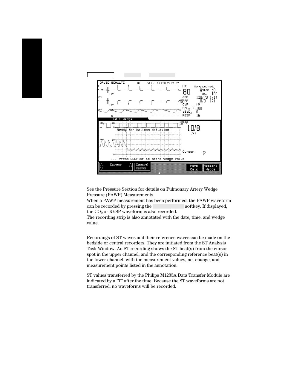 St recordings, St recordings -18 | Philips V24CT User Manual | Page 190 / 392