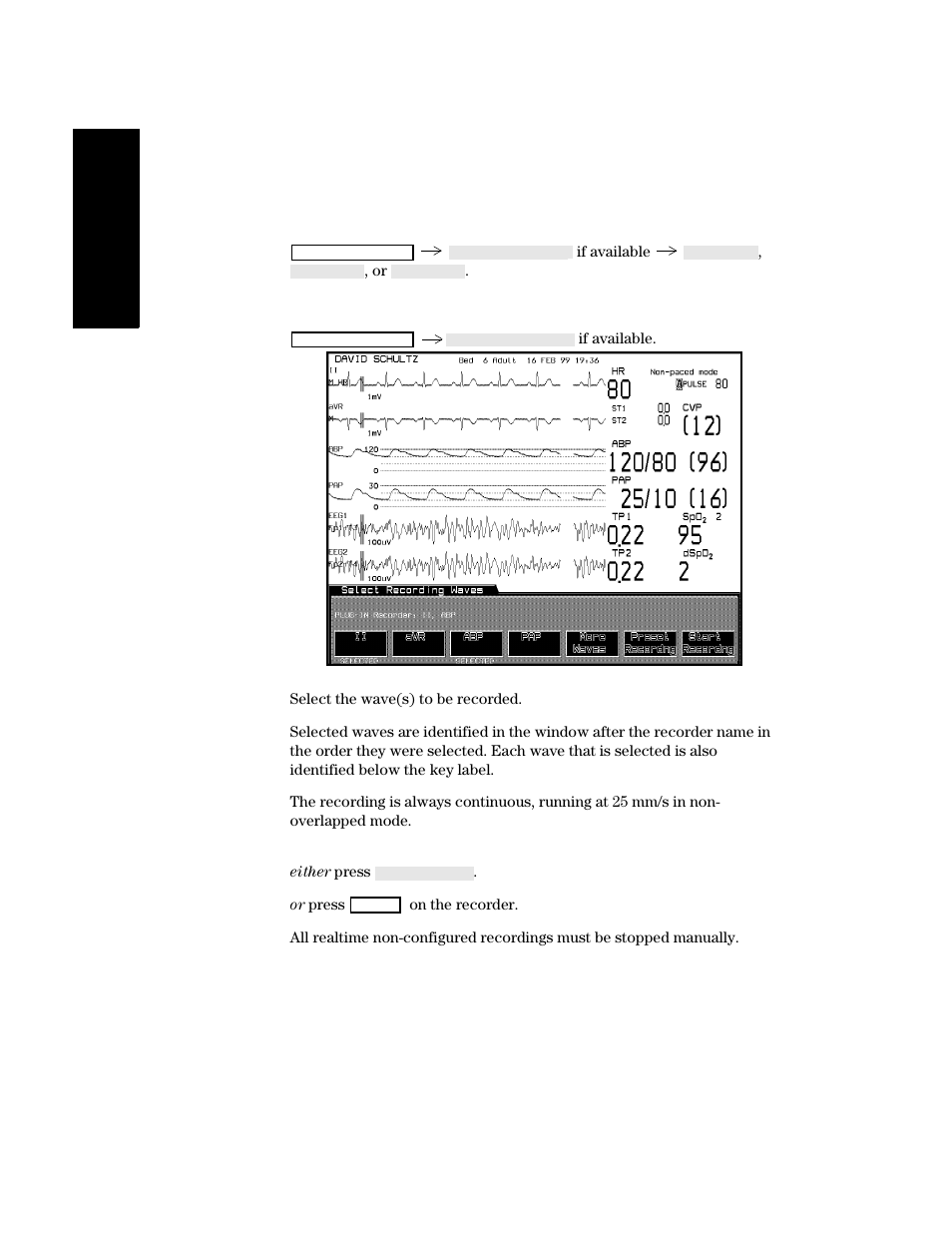 Making preset recordings, Making non- preset recordings | Philips V24CT User Manual | Page 194 / 392