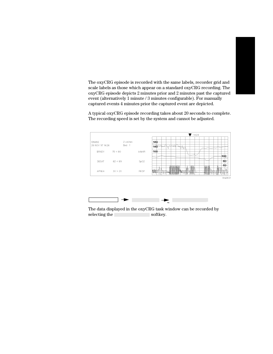 Philips V24CT User Manual | Page 207 / 392