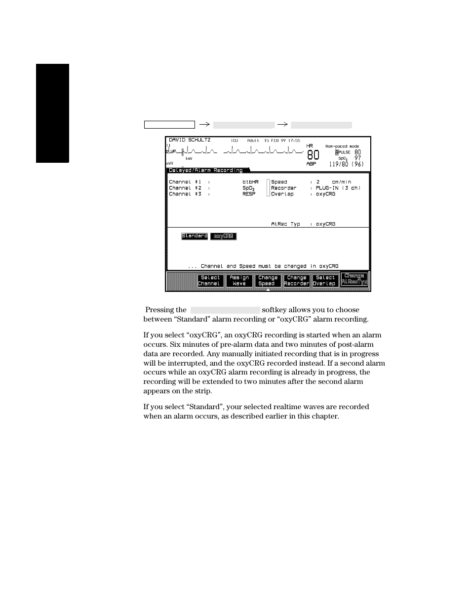 Oxycrg alarm recording, Oxycrg alarm recording -38 | Philips V24CT User Manual | Page 210 / 392