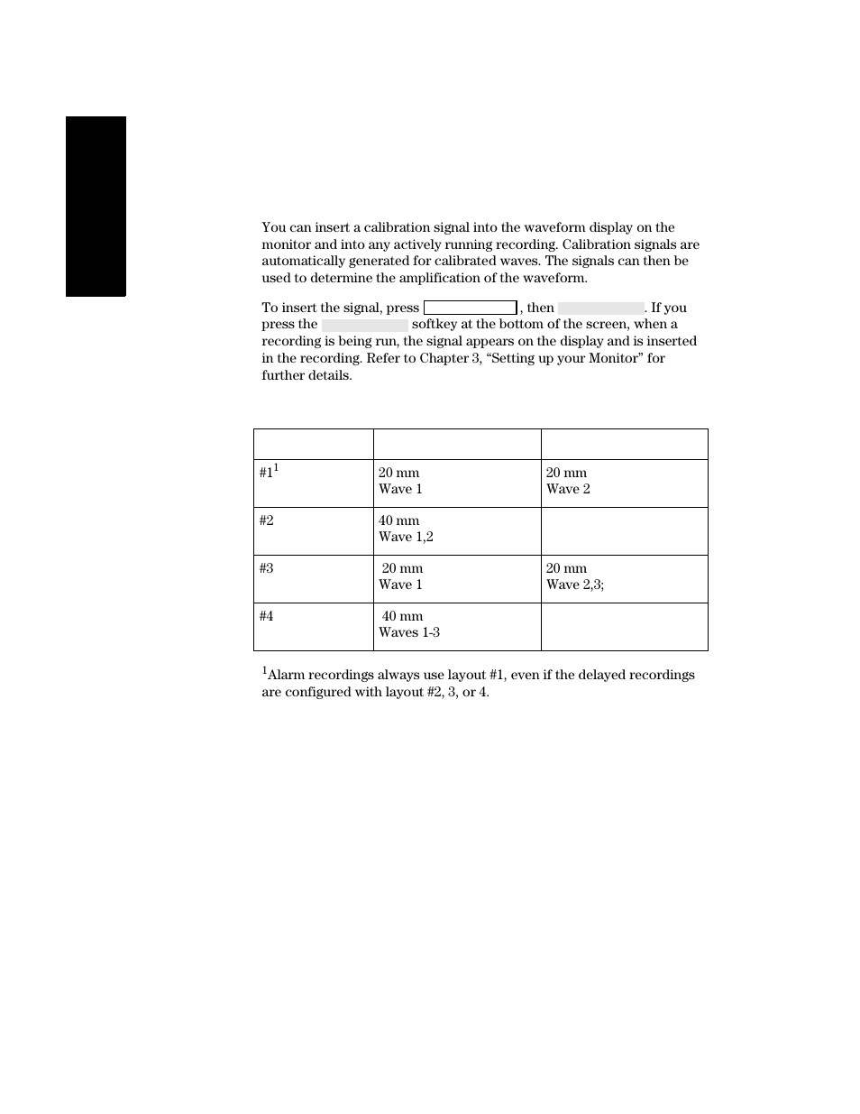 Inserting a calibration signal, Recording layouts | Philips V24CT User Manual | Page 216 / 392