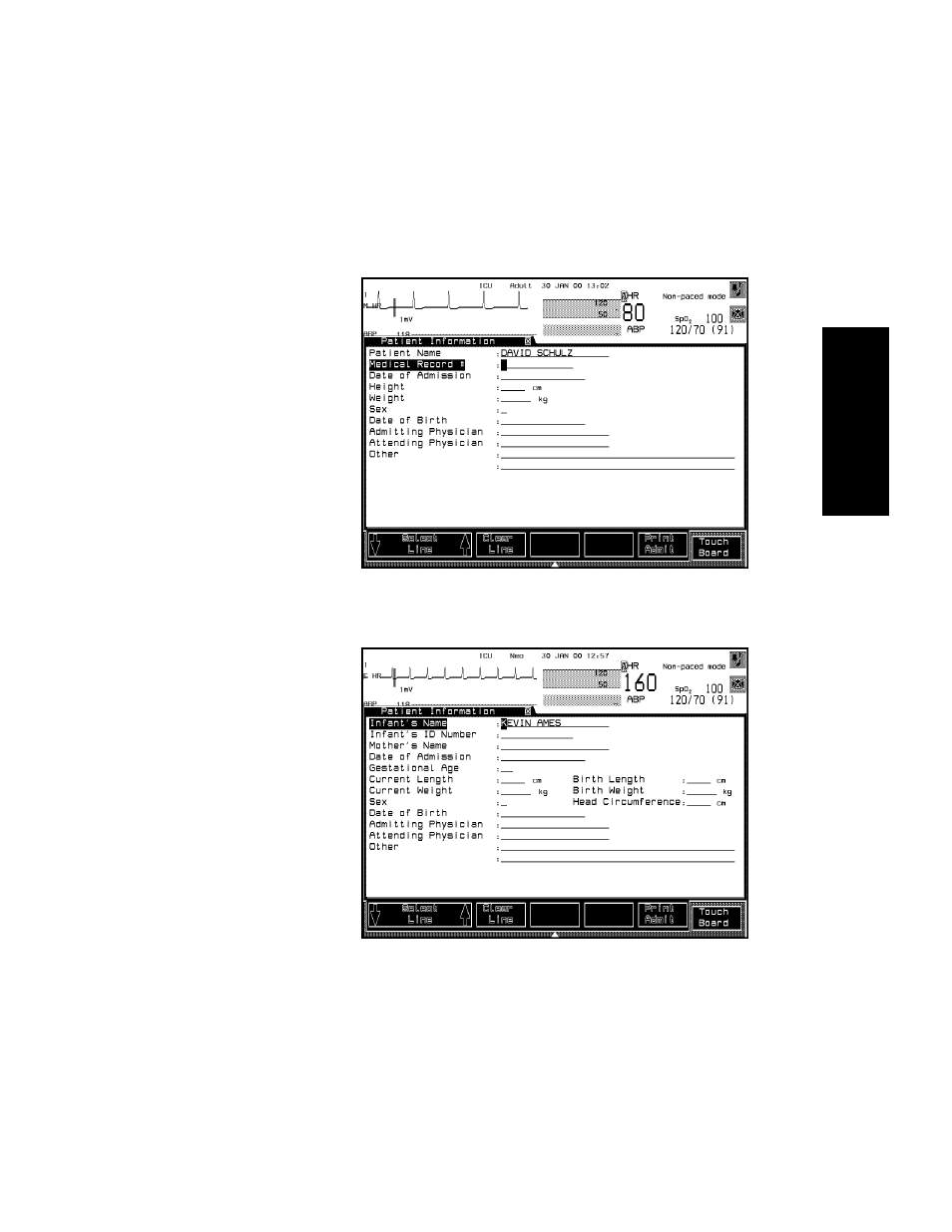 Philips V24CT User Manual | Page 235 / 392
